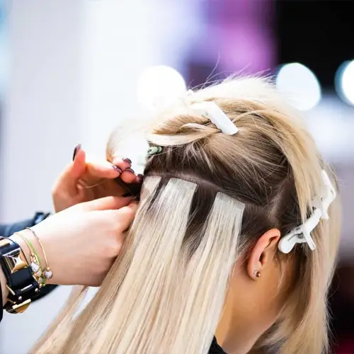 Hair Replacement Service Provider in Noida
