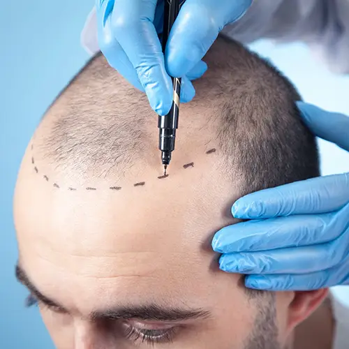 Smart Hair Concept