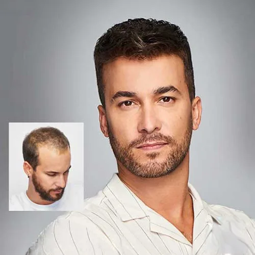 Hair Fixing